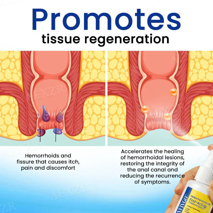 Fivfivgo® Herbal Hemorrhoids Fast-Acting Treatment Spray