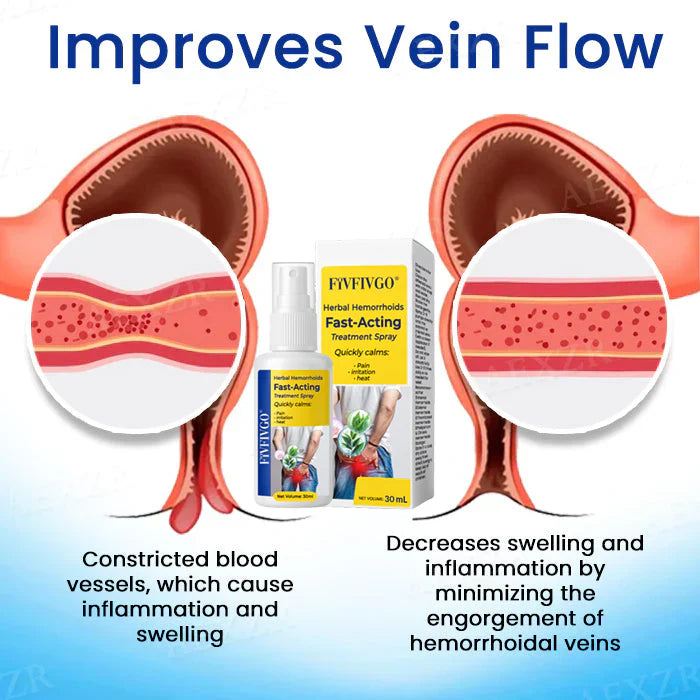 Fivfivgo® Herbal Hemorrhoids Fast-Acting Treatment Spray